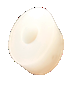Elastomer  Replacement